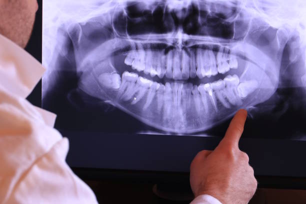 Best Emergency Treatment for Dental Infections or Abscesses in White Pine, TN